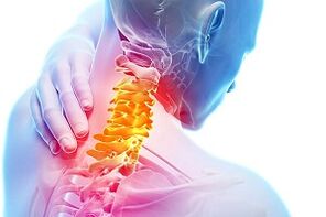 Symptômes de l'ostéochondrose du cou et des règles nutritionnelles pour les maladies